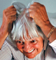 Excited lady with hair loss problem